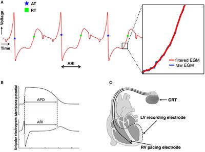 Autonomic Modulation in Patients with Heart Failure Increases Beat-to-Beat Variability of Ventricular Action Potential Duration